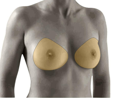 Amoena Natura 3E Breast Form 397 on a women's body 